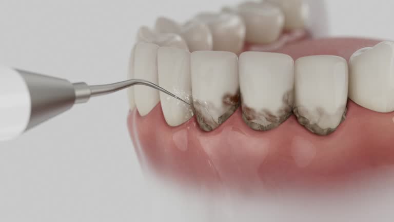 Reliable Dental contractor in Lake Catherine, IL by Dentist Open Now